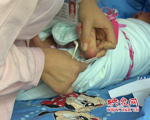 醫(yī)護(hù)人員在為一名新出生嬰兒采足跟血，做疾病篩查