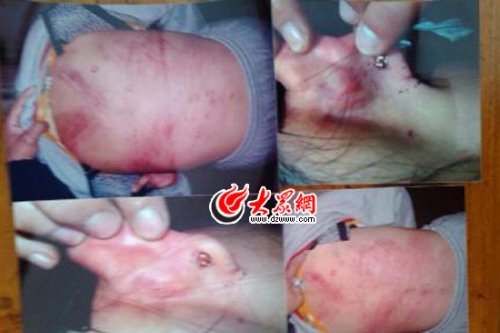 　山東藝術(shù)設(shè)計(jì)學(xué)院16歲女生宿舍內(nèi)被女同學(xué)暴打4小時(shí)。