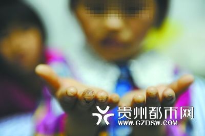指尖被針扎得傷痕累累。