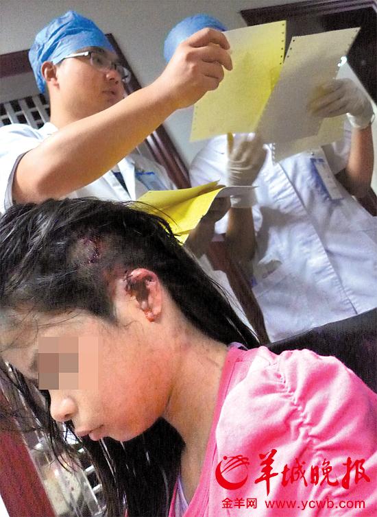 受傷的11歲女孩頭發(fā)被卷入扶梯，耳朵被嚴重拉傷，需手術(shù)。