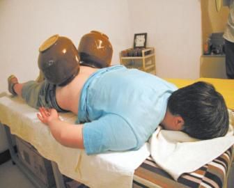 拔泡菜壇子火罐。