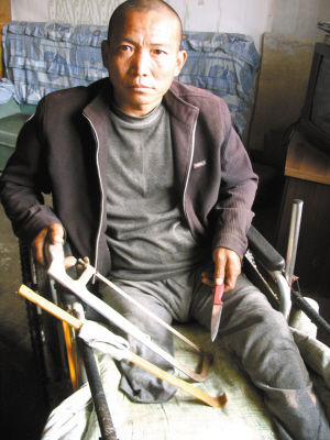 鄭艷良就是用這幾樣簡(jiǎn)陋工具，給自己做了右腿截肢手術(shù)。
