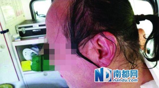 涉事教師遭熱水潑臉后的照片。