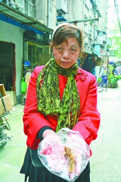 頭部受傷的黃女士展示兩根大魚(yú)刺。