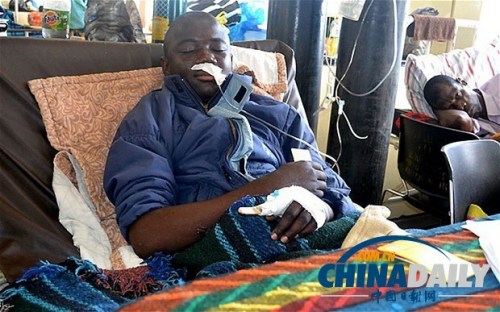 雖然已經(jīng)在醫(yī)院接受了近一個(gè)月的恢復(fù)治療，卡托卡的身體仍然非常虛弱。
