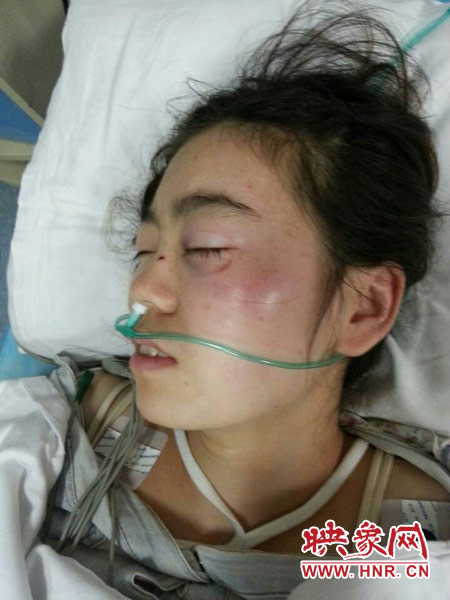 9月10日晚,被暴打的小陳出現(xiàn)了間歇性昏迷,被送進(jìn)了省人民醫(yī)院。