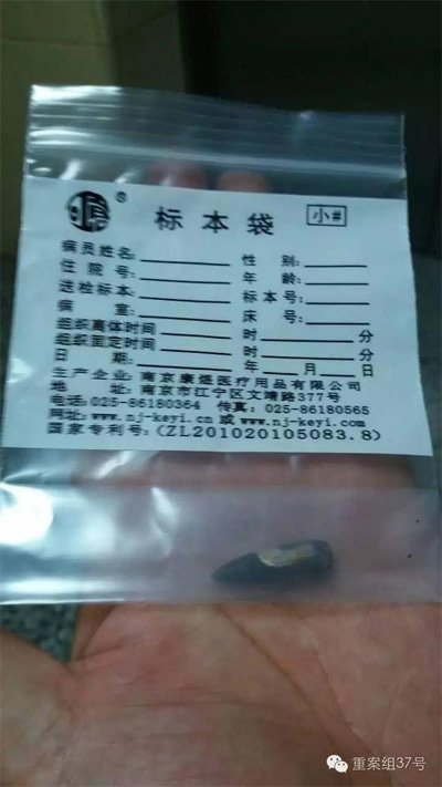 經(jīng)警方鑒定，秦女士體內(nèi)取出的子彈系56式步槍射出 。 受訪者供圖