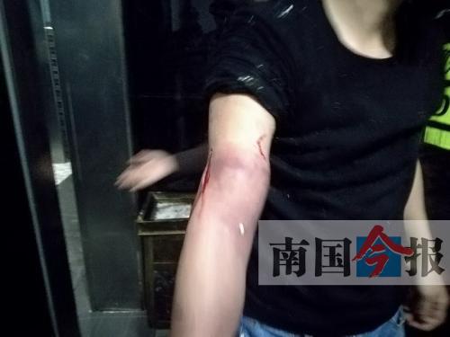 覃先生手臂被卡的部位受傷流血，所幸傷勢(shì)無大礙。 通訊員 王建民 攝