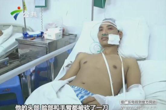 另一名傷者頭部、臉部和手臂都被砍了一刀。(視頻截圖)