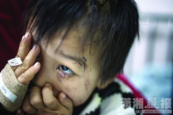 1月13日，湖南省兒童醫(yī)院，4歲的源源用手蒙住了眼睛。