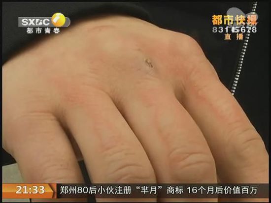 說(shuō)到這足療拔罐，估計(jì)大伙都不陌生，但是想起4號(hào)晚上的拔罐的經(jīng)歷，呂先生現(xiàn)在想起來(lái)，還心有余悸。