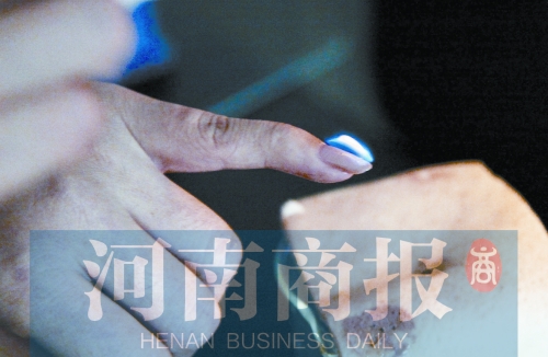 將指甲油涂在指甲上，靠近火焰時(shí)被引燃了