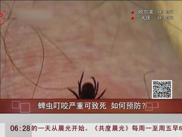 蜱蟲(chóng)叮咬嚴(yán)重可致死如何預(yù)防？